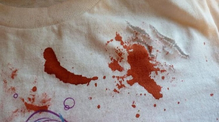 Limpieza una mancha de sangre en ropa